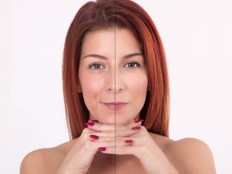 How Long Does it Take For Collagen Supplements To Work 3 What are the benefits of taking collagen supplements?
