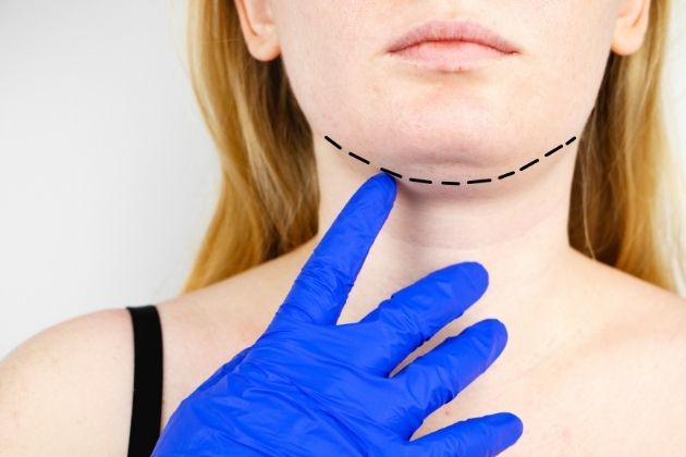 Lipolysis To Get Rid of Neck Fat