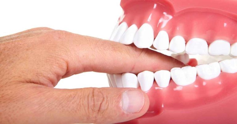 Itchy Teeth: What Causes Them and How to Treat Them